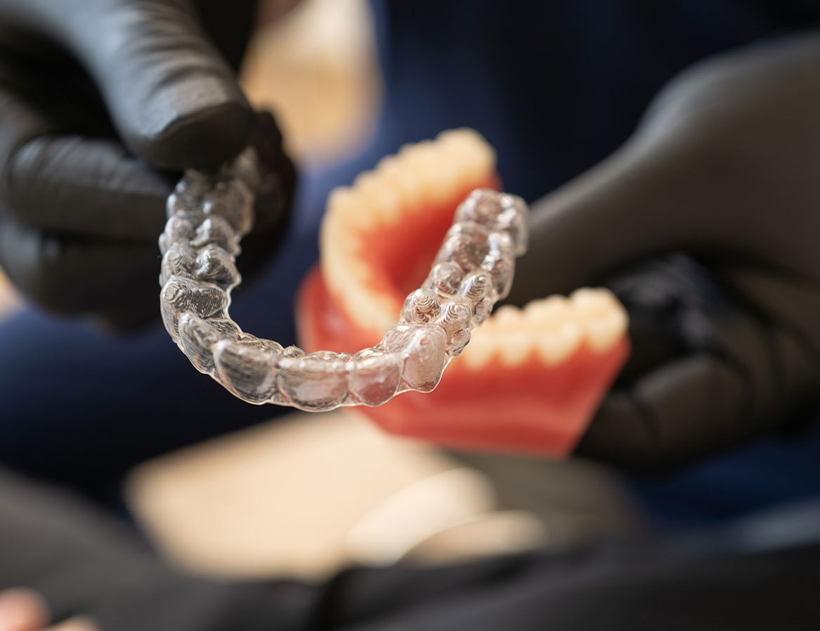 praxis am anker wiesloch zahnkorrektur aligner